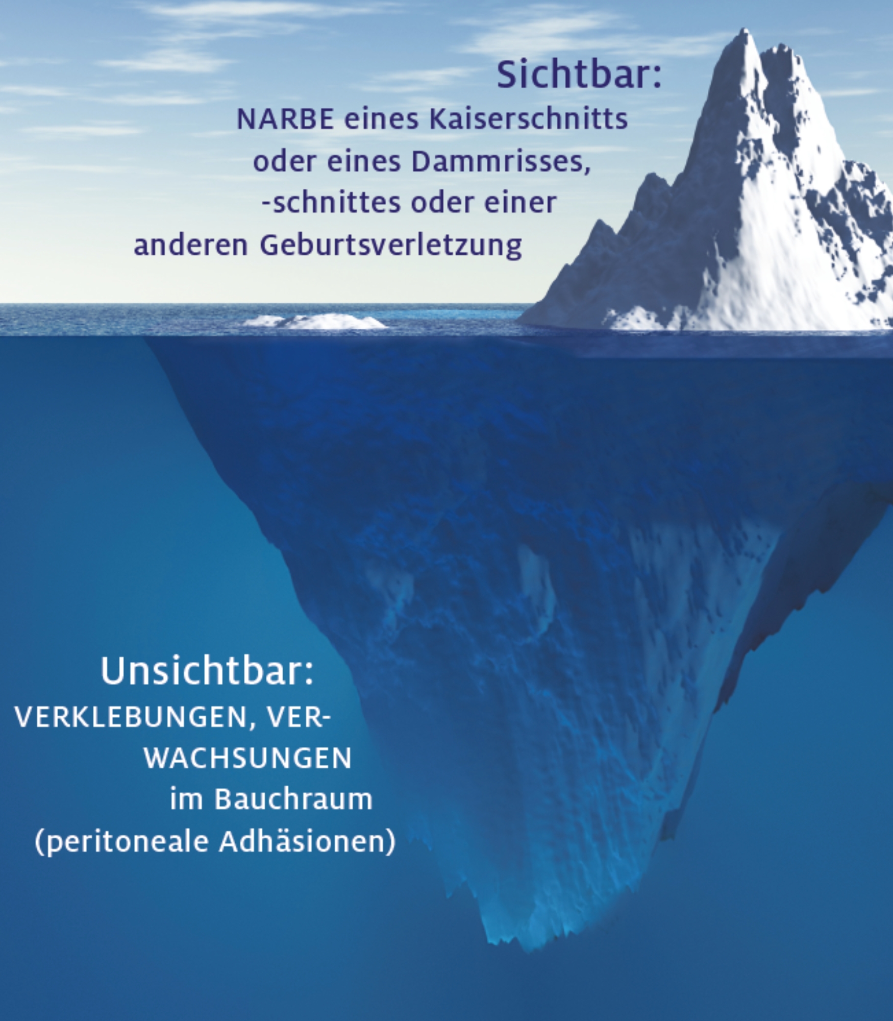 Eisberg_über_und_unter_Wasser
